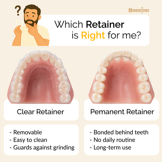 Which retainer is right for you?